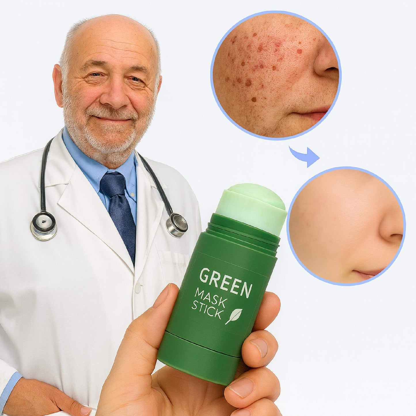 ClearSkin™ Reinigungs-Stick | Entferne Pickel und erhalte in 5 Tagen eine ebenmäßige Haut