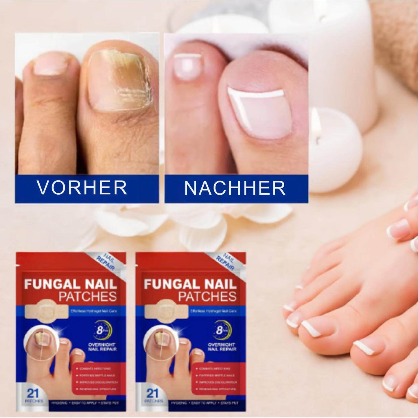 DermiPatch™ | Nagelpilz dauerhaft loswerden – sichtbare Ergebnisse in nur 2 Wochen!