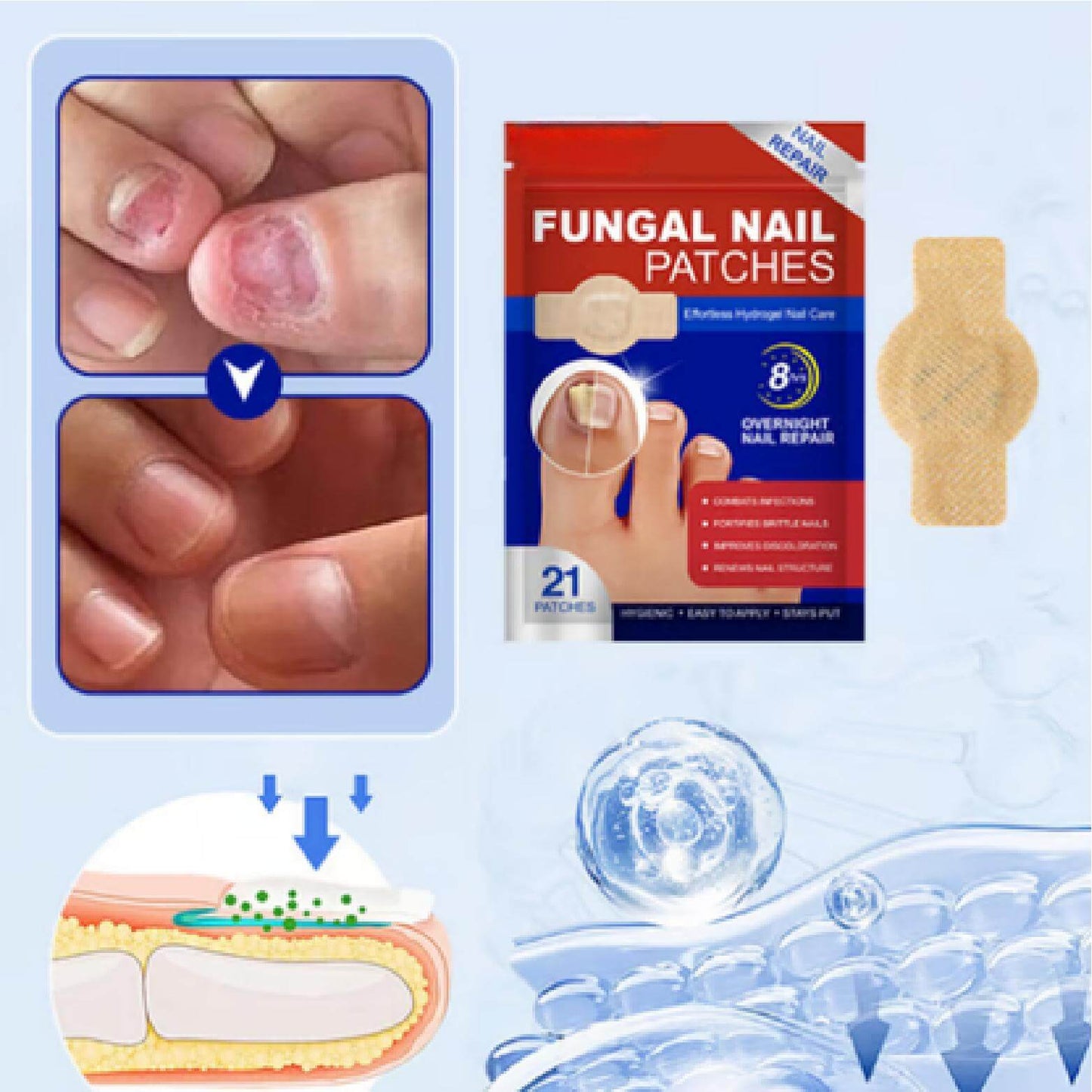 DermiPatch™ | Nagelpilz dauerhaft loswerden – sichtbare Ergebnisse in nur 2 Wochen!