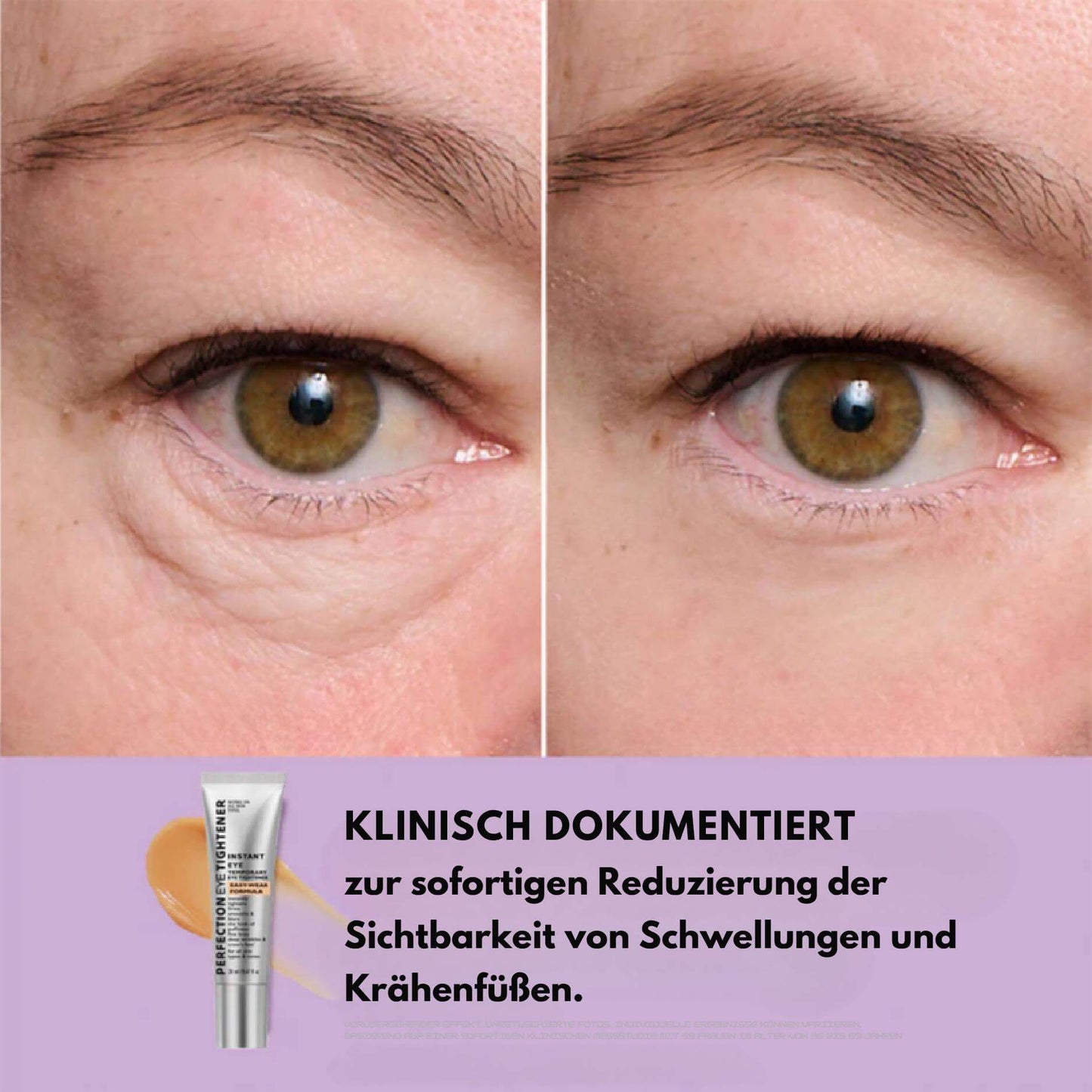 EyeMiracle™ | Augenstraffungs-Creme | Reduziert Tränensäcke, Schwellungen und feine Linien in Sekunden