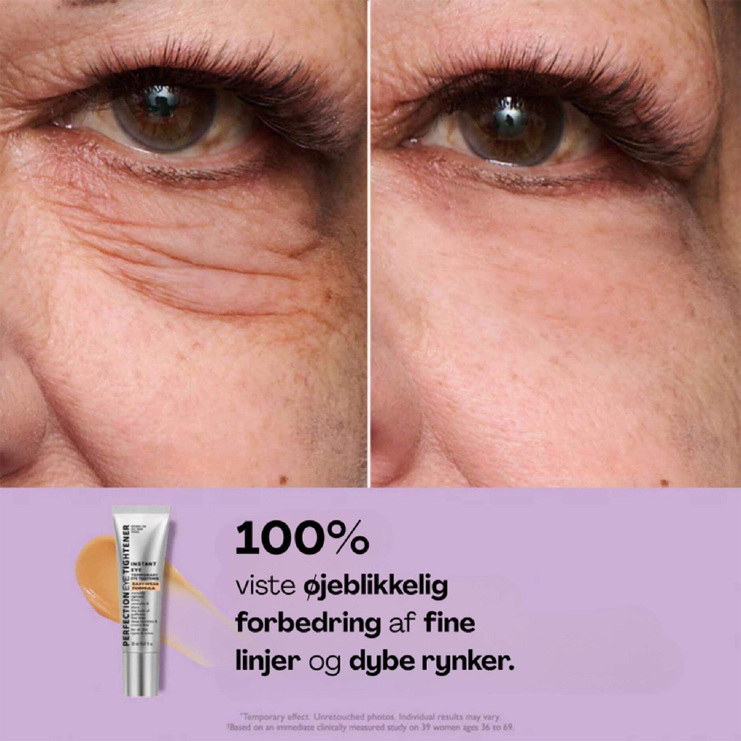 EyeMiracle™ | Augenstraffungs-Creme | Reduziert Tränensäcke, Schwellungen und feine Linien in Sekunden