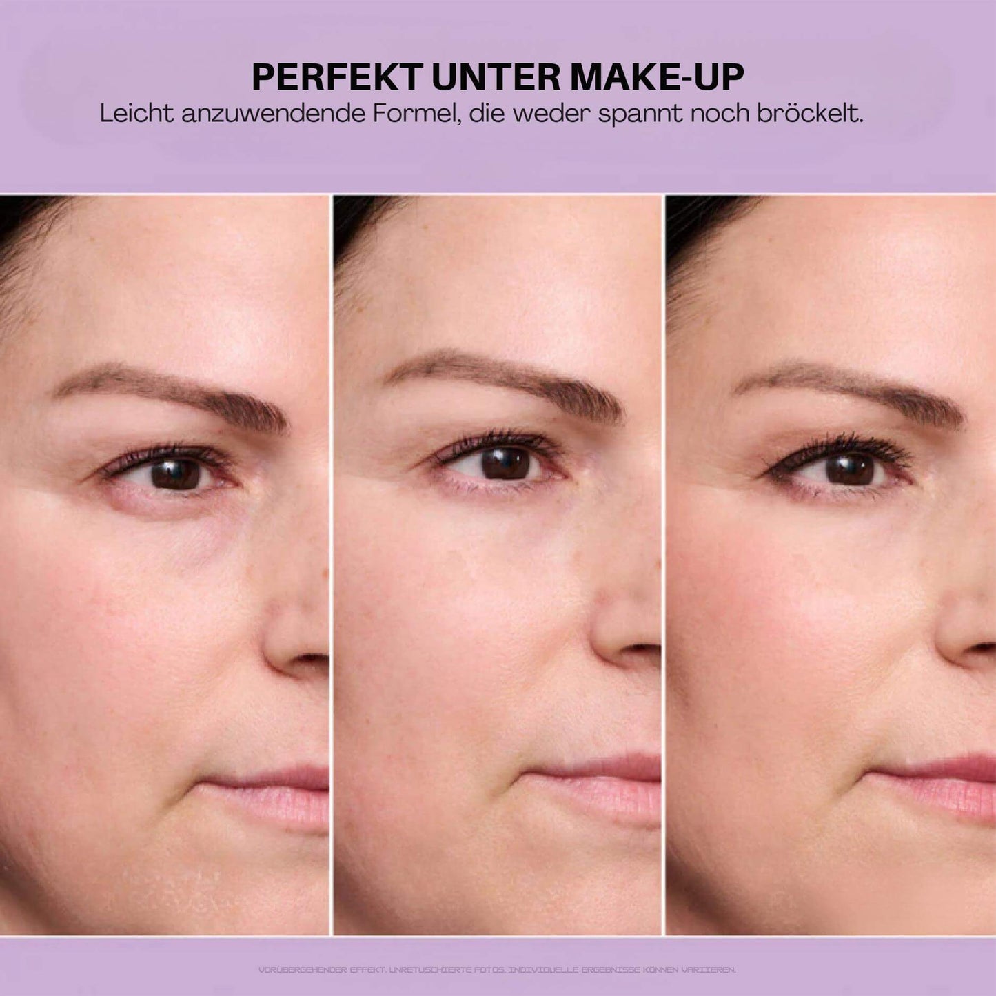 EyeMiracle™ | Augenstraffungs-Creme | Reduziert Tränensäcke, Schwellungen und feine Linien in Sekunden