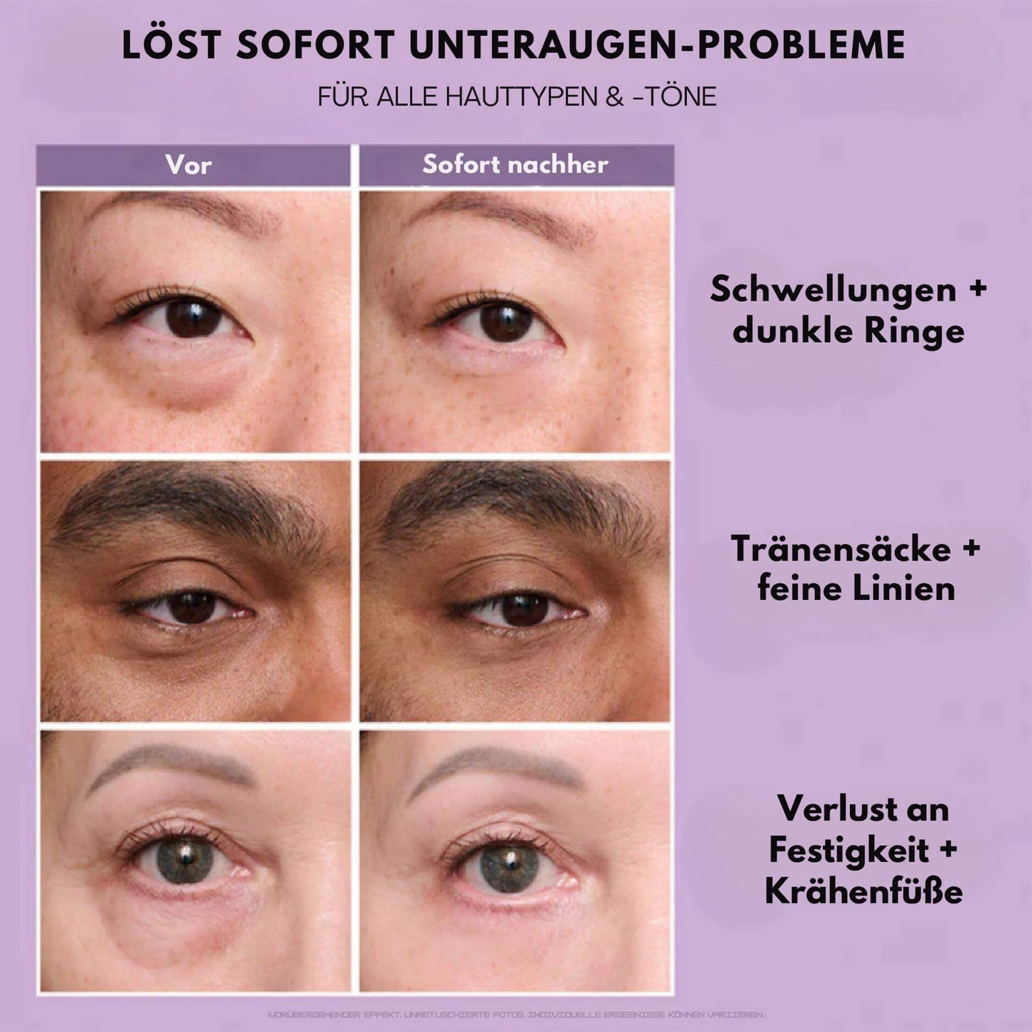 EyeMiracle™ | Augenstraffungs-Creme | Reduziert Tränensäcke, Schwellungen und feine Linien in Sekunden