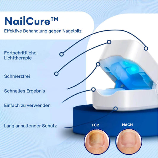 NailCure™ – Effektive Behandlung gegen Nagelpilz