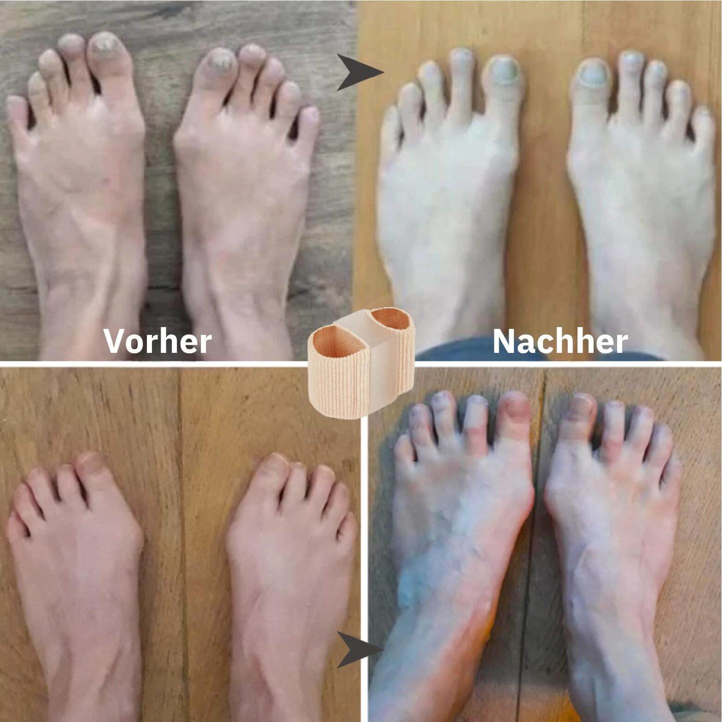 ToeAlign™ – Richtet deine Zehen sanft wieder aus