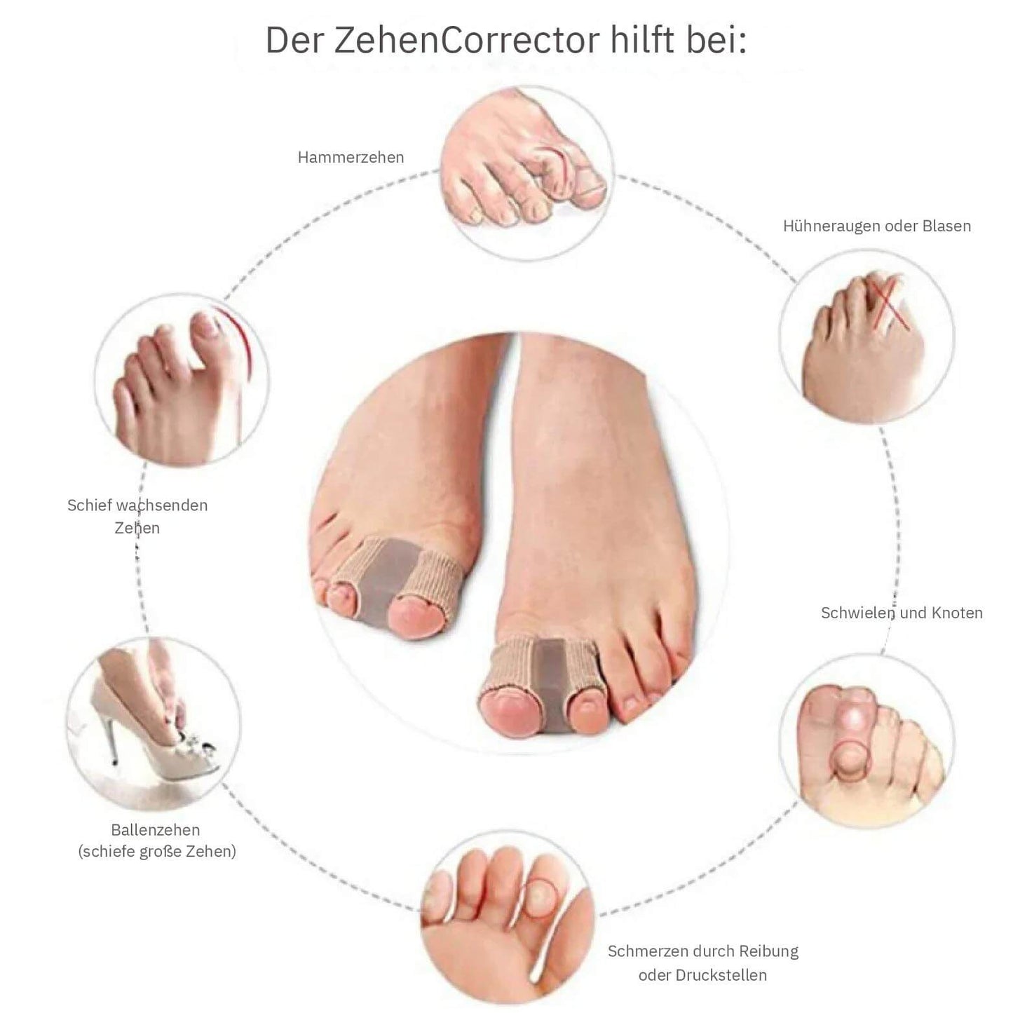 ToeAlign™ – Richtet deine Zehen sanft wieder aus