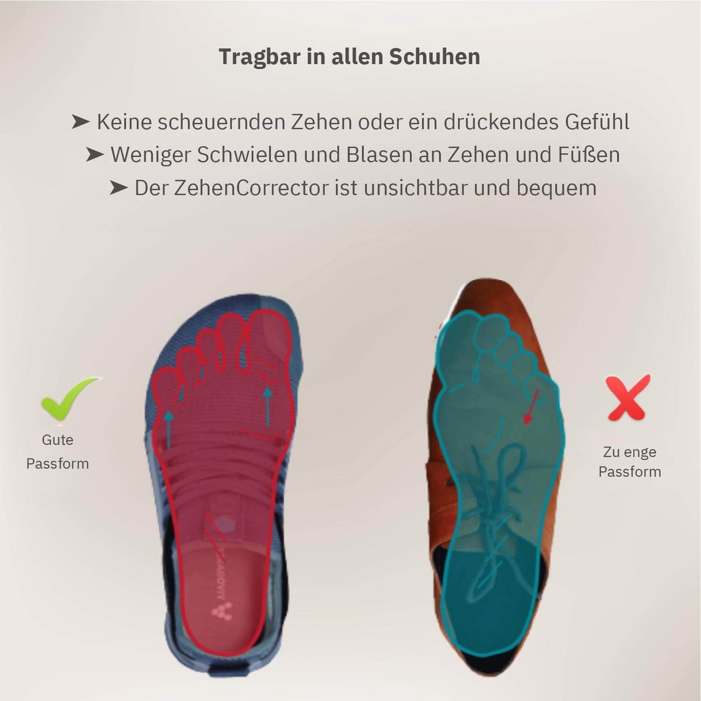 ToeAlign™ – Richtet deine Zehen sanft wieder aus