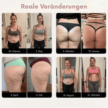 ActiveShape™ | Anti-Cellulite-Leggings mit aktiver Stimulation