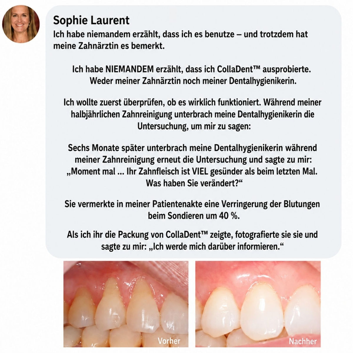 CollaDent™ | Renforcez vos gencives de l’intérieur et préservez votre sourire naturel