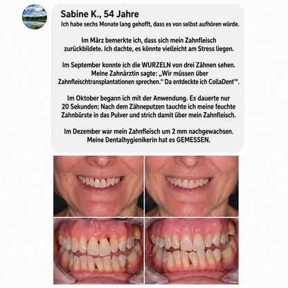 CollaDent™ | Renforcez vos gencives de l’intérieur et préservez votre sourire naturel