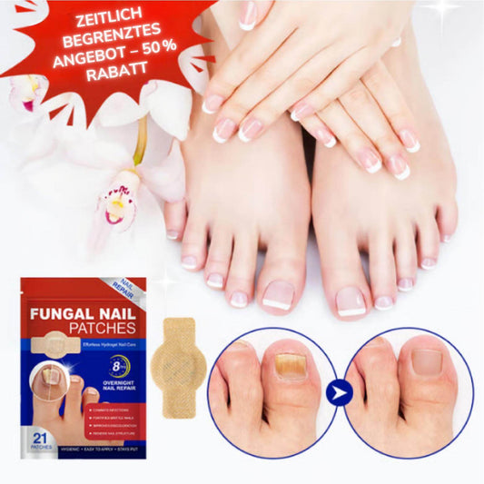 DermiPatch™ | Nagelpilz dauerhaft loswerden – sichtbare Ergebnisse in nur 2 Wochen!