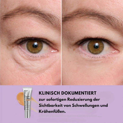 EyeMiracle™ | Augenstraffungs-Creme | Reduziert Tränensäcke, Schwellungen und feine Linien in Sekunden