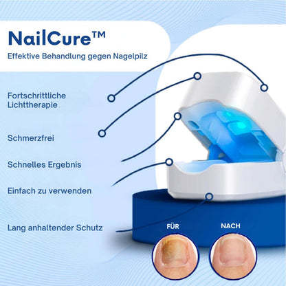 NailCure™ – Effektive Behandlung gegen Nagelpilz