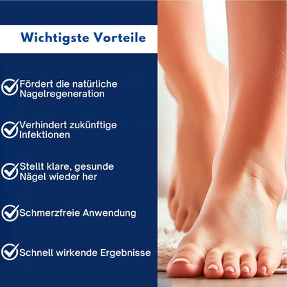 NailCure™ – Effektive Behandlung gegen Nagelpilz