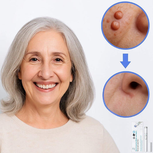 Scarless™ Warzenentferner Stift | Entfernt dunkle Flecken & Warzen schmerzfrei in nur 3 Tagen