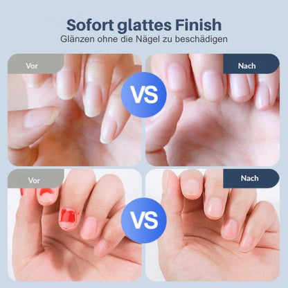 TrimEase™ | Machen Sie die Nagelpflege wieder sicher und mühelos